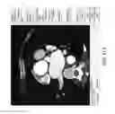 Fig. 18 - Evaluation system or determination of cardiovascular function parameters