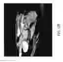 Fig. 22 - Evaluation system or determination of cardiovascular function parameters