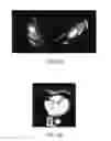 Fig. 24 - Evaluation system or determination of cardiovascular function parameters