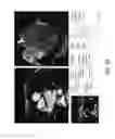Fig. 26 - Evaluation system or determination of cardiovascular function parameters