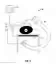 Fig. 04 - Fluoroscopic pose estimation