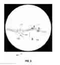 Fig. 09 - Fluoroscopic pose estimation