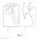 Fig. 04 - Prior image based three dimensional imaging