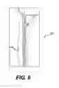 Fig. 10 - Systems and methods for visualizing elongated structures and detecting branches therein