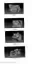 Fig. 06 - METHOD AND SYSTEM FOR AUTOMATICALLY ALIGNING MODELS OF AN UPPER JAW AND A LOWER JAW