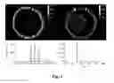 Fig. 04 - Parallel elemental and molecular mass spectrometry analysis with laser ablation sampling
