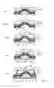 Fig. 06 - Semiconductor light emitting element