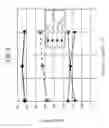 Fig. 06 - VARIABLE CAPACITANCE CIRCUIT, VARIABLE CAPACITANCE DEVICE, RESONANT CIRCUIT, AMPLIFYING CIRCUIT, AND ELECTRONIC APPARATUS
