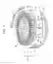 Fig. 02 - Stator with neutral line secured to stator yoke