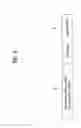 Fig. 10 - Resource allocation method and a method for transmitting/receiving resource allocation information in mobile communication system