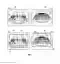 Fig. 06 - Grid-based image resolution enhancement for video processing module