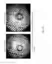 Fig. 19 - Endoscope with multiple views and novel configurations adapted thereto