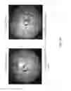 Fig. 20 - Endoscope with multiple views and novel configurations adapted thereto