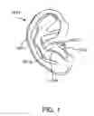 Fig. 02 - Earpiece positioning and retaining