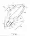 Fig. 04 - Earpiece positioning and retaining