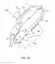 Fig. 10 - Earpiece positioning and retaining