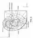 Fig. 19 - Earpiece positioning and retaining