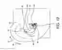Fig. 22 - Earpiece positioning and retaining