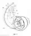 Fig. 27 - Earpiece positioning and retaining