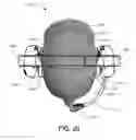 Fig. 12 - Restricted ball and socket joint for headset earcup