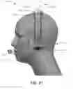 Fig. 13 - Restricted ball and socket joint for headset earcup