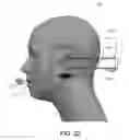 Fig. 14 - Restricted ball and socket joint for headset earcup