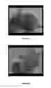 Fig. 06 - Vector construct with human hypoxia inducible factor α gene