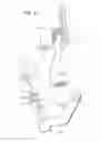 Fig. 05 - Custom Electric Nail Vaporizing Unit