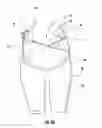 Fig. 05 - Compression bands, garments and related methods