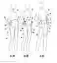 Fig. 11 - Compression bands, garments and related methods
