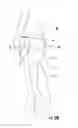Fig. 13 - Compression bands, garments and related methods