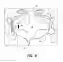 Fig. 07 - A FACEMASK HAVING ONE OR MORE NANOFIBER LAYERS