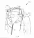 Fig. 10 - Clothing top for technology concealment
