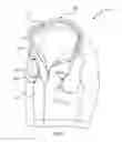 Fig. 22 - Clothing top for technology concealment