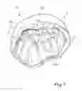 Fig. 03 - IMPACT-ABSORBING HELMET