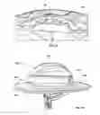 Fig. 09 - Brim for attaching to headgear