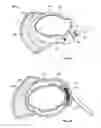 Fig. 13 - Brim for attaching to headgear