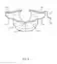 Fig. 04 - ANTIMICROBIAL PROTECTIVE FOOT COVER