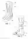 Fig. 02 - Achilles heel wedge