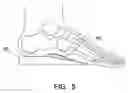 Fig. 04 - Achilles heel wedge