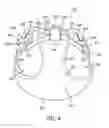 Fig. 05 - Adjustable heel support member for article of footwear
