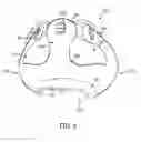 Fig. 07 - Adjustable heel support member for article of footwear