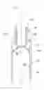 Fig. 01 - Wiper for a Cosmetic Product Container, Container Comprising such a Wiper and Applicator Assembly Comprising such a Container