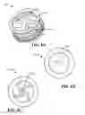 Fig. 07 - Shear blade assembly for a blender