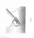 Fig. 06 - Substantially rigid and stable endoluminal surgical suite for treating a gastrointestinal lesion