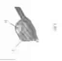 Fig. 09 - Substantially rigid and stable endoluminal surgical suite for treating a gastrointestinal lesion