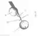 Fig. 13 - Substantially rigid and stable endoluminal surgical suite for treating a gastrointestinal lesion