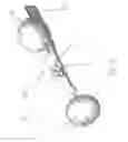 Fig. 16 - Substantially rigid and stable endoluminal surgical suite for treating a gastrointestinal lesion