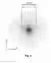 Fig. 05 - METHOD AND SYSTEM FOR IMPROVING VISION OF AN EYE WITH MACULAR DEGENERATION