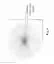Fig. 07 - METHOD AND SYSTEM FOR IMPROVING VISION OF AN EYE WITH MACULAR DEGENERATION